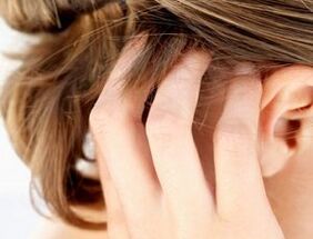 segni e sintomi della psoriasi sul cuoio capelluto